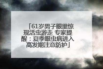 61岁男子眼里惊现活虫游走 专家提醒：夏季眼虫病进入高发期注意防护